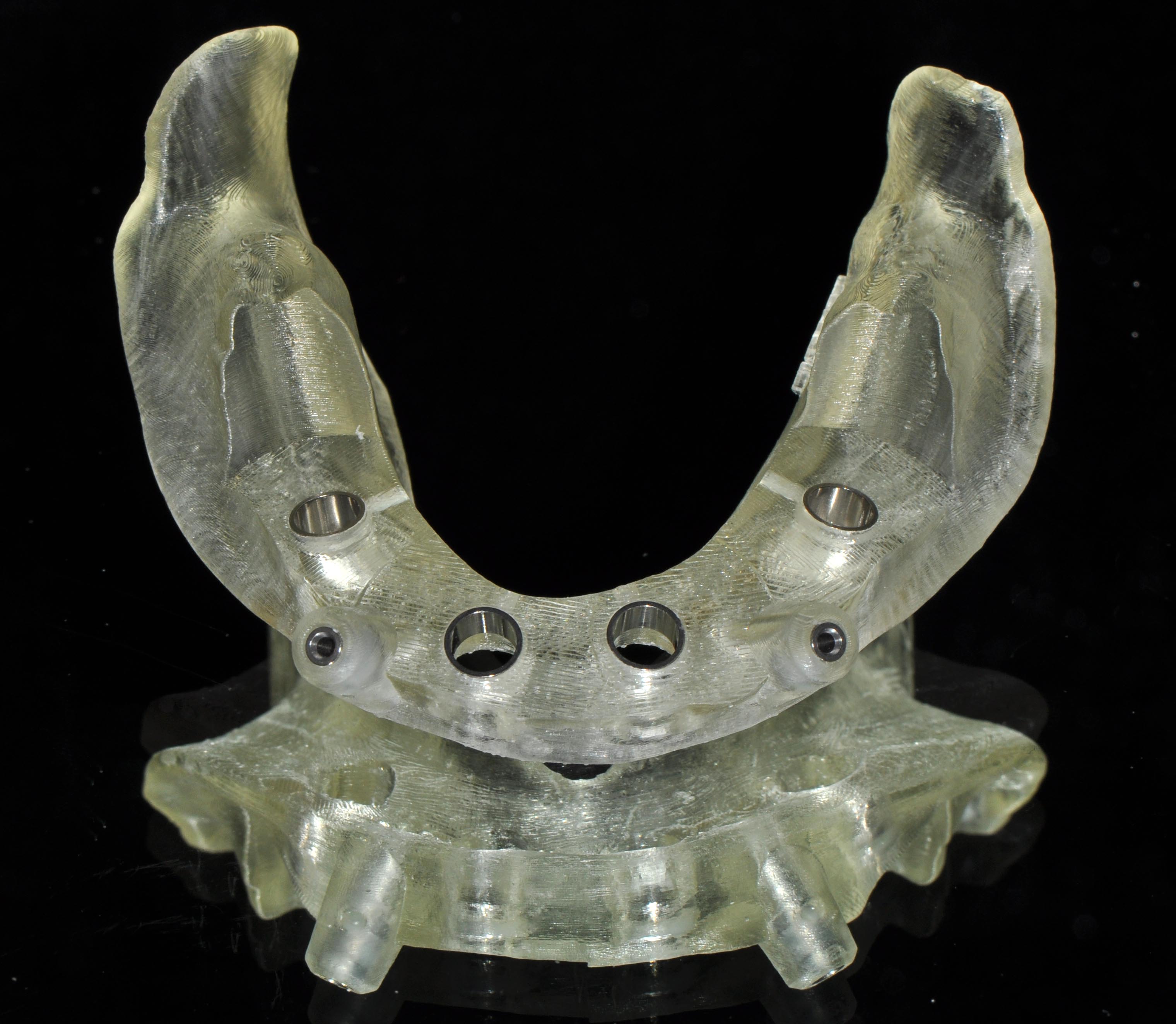 Guided surgery with drill guides